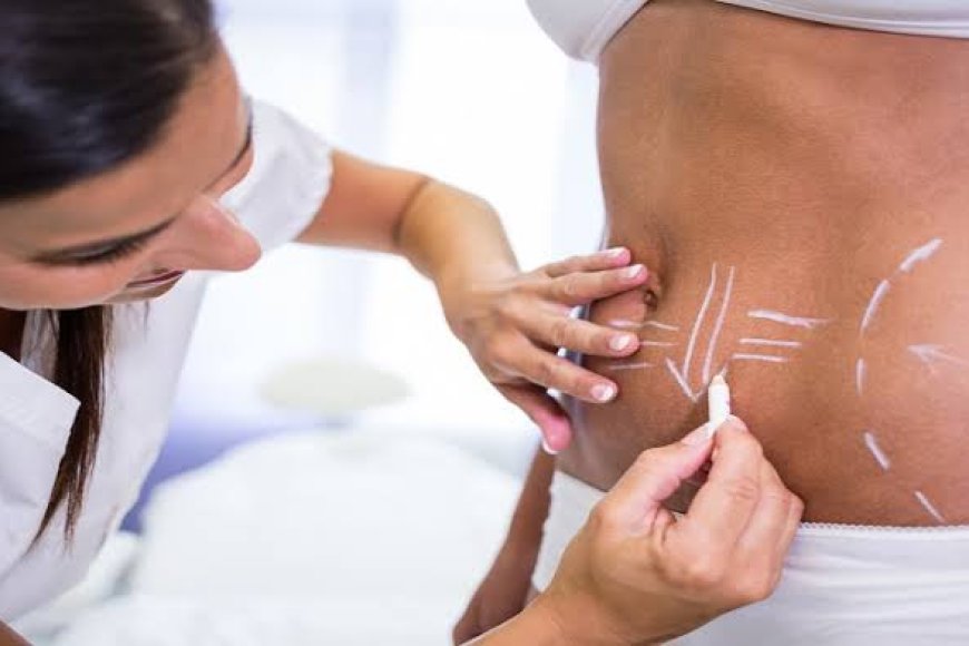 Liposuction in Riyadh and Post-Procedure Care