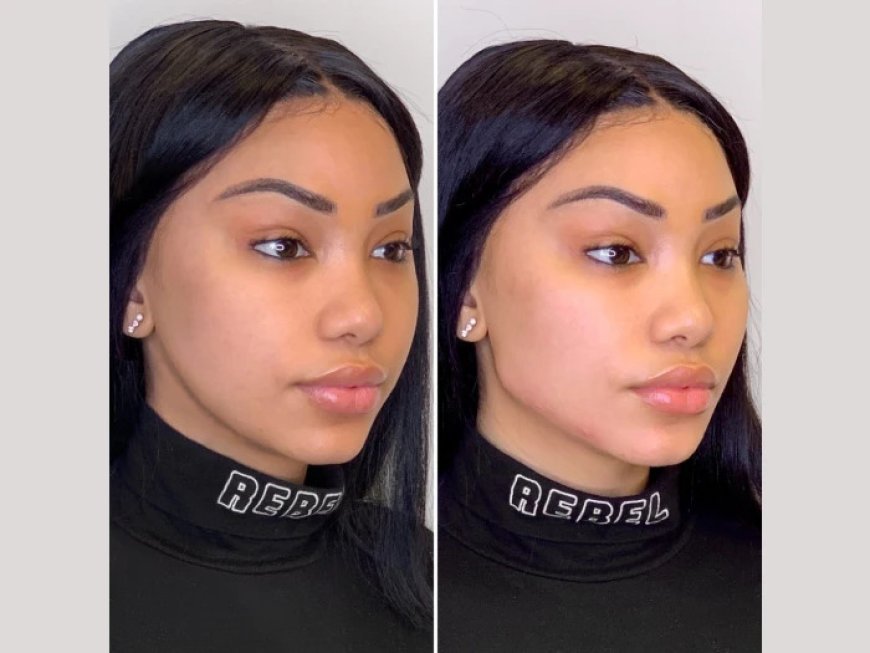 Best Plastic Surgeons in Dubai for Advanced Facial Lifting