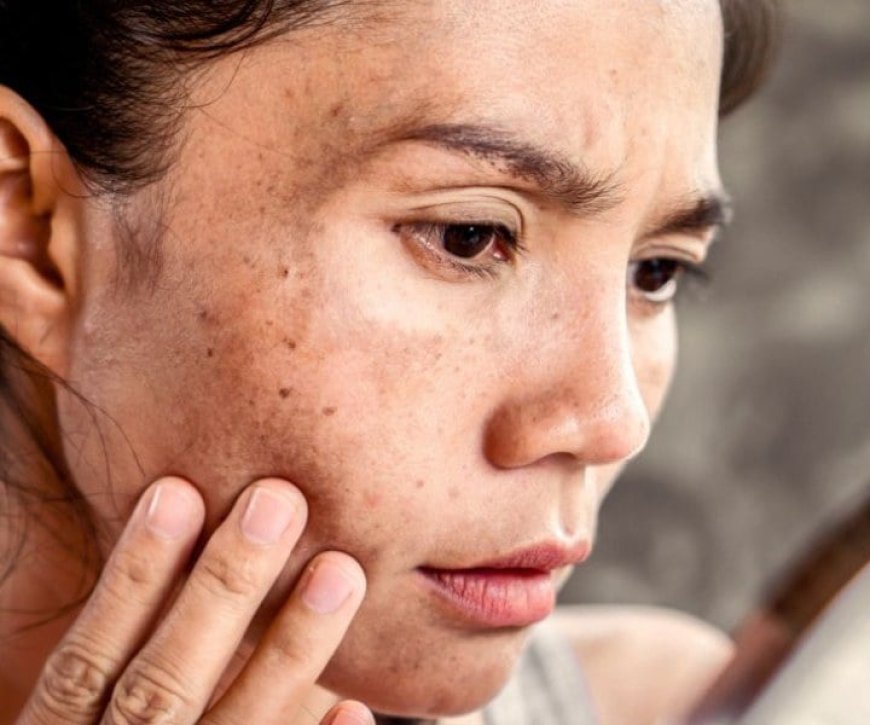 What happens during a Dermal Pigmentation Treatment appointment?