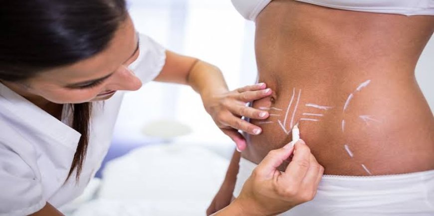 Liposuction in Riyadh and Post-Procedure Care