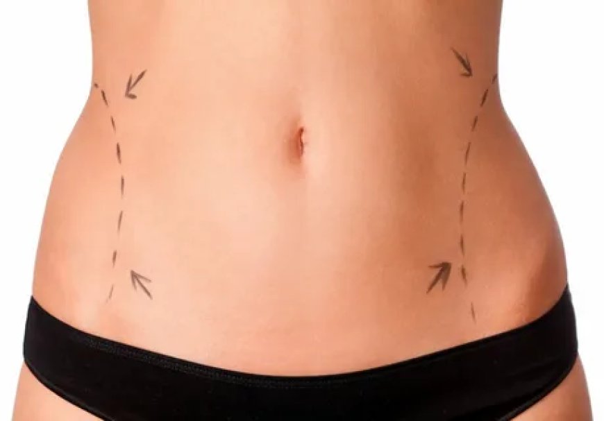Liposuction in Dubai: Advanced Techniques and Care