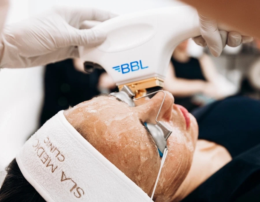BBL Laser in Manchester: Advanced Light Therapy for Brighter, Clearer Skin