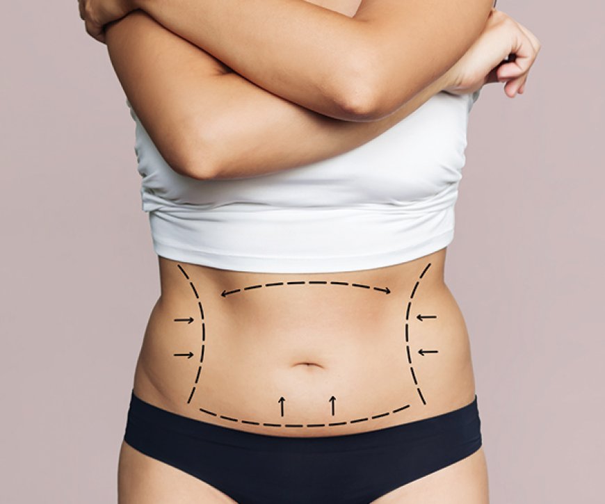 Best Tummy Tuck Surgeon in Dubai: How to Select a Trusted Specialist