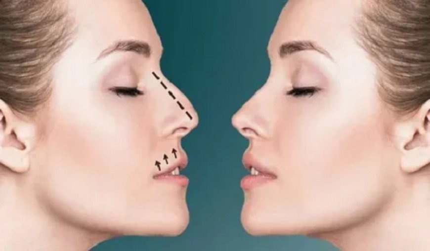 Rhinoplasty in Dubai: Expert Guide to Nasal Refinement