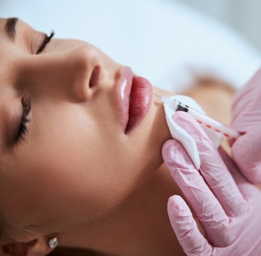 Lip Fillers Cost in India: Pricing, Procedure, Benefits, and Recovery Guide