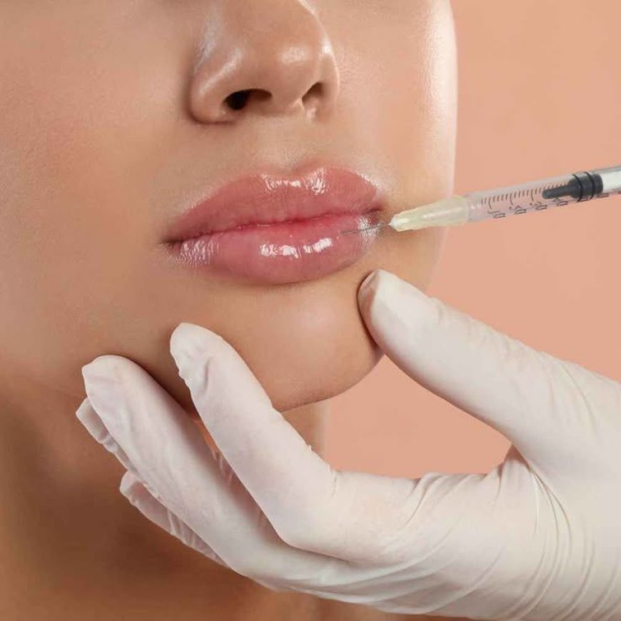 Lip Fillers injection in Dubai: Advanced Tips