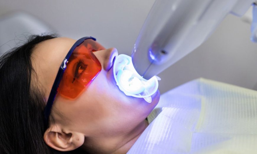 How to Keep Your White Smile After a Professional Whitening Treatment