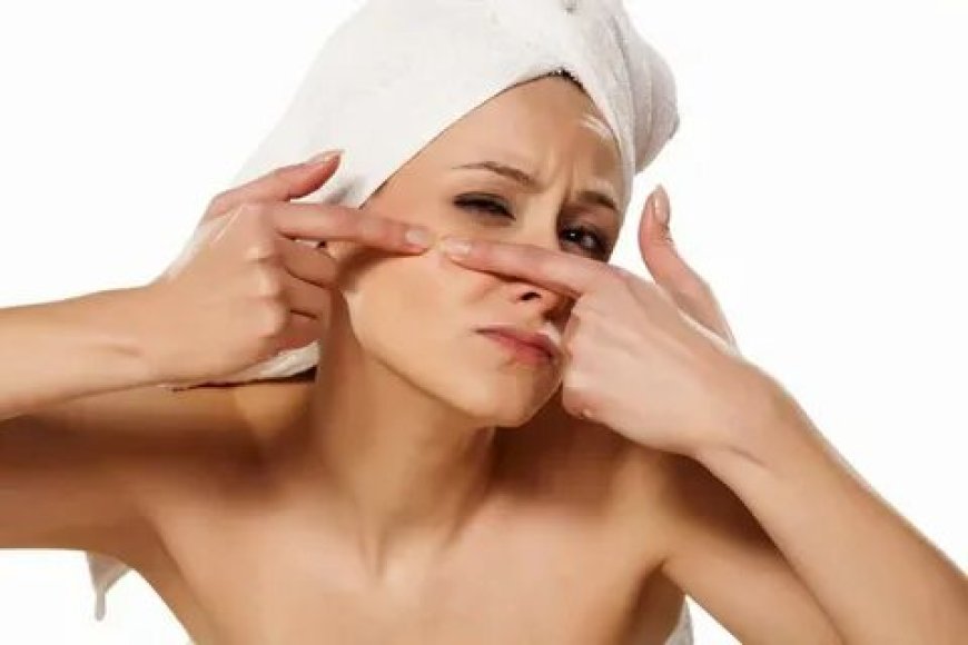 Affordable Acne Treatment Services with Personalized Skin Care Plans