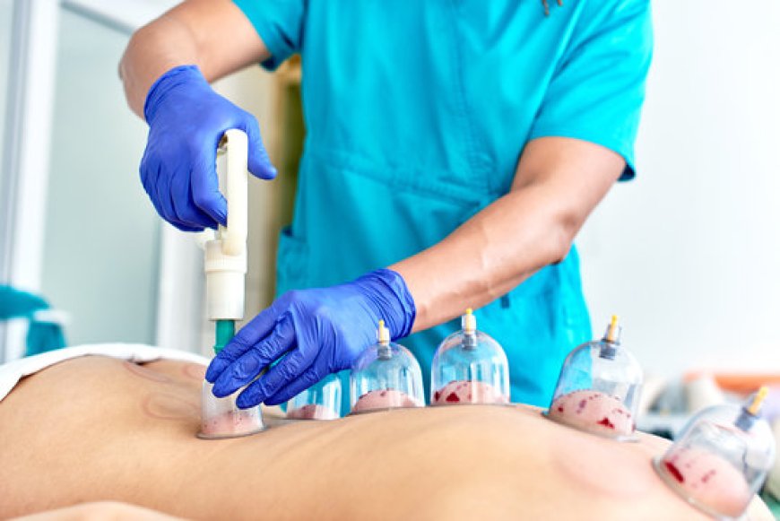 Why Hijama Therapy Is Becoming a Popular Choice for Natural Healing?