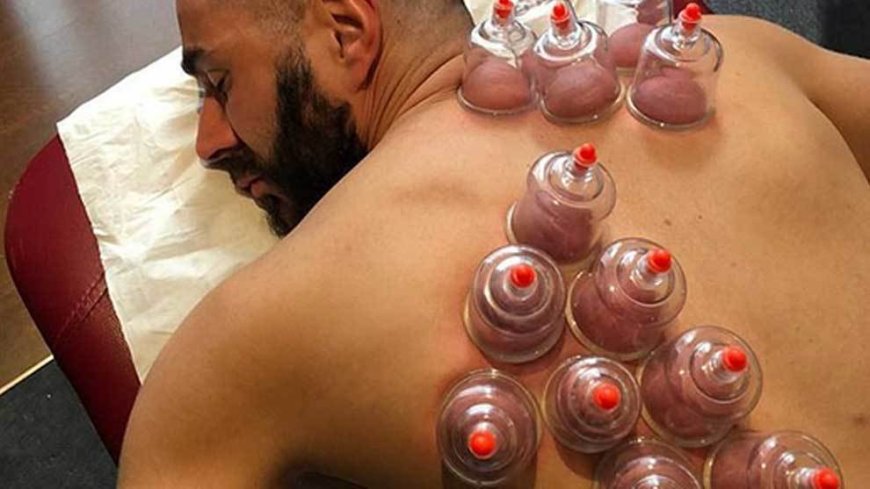 Why Hijama Therapy Is Becoming a Popular Choice for Natural Healing?