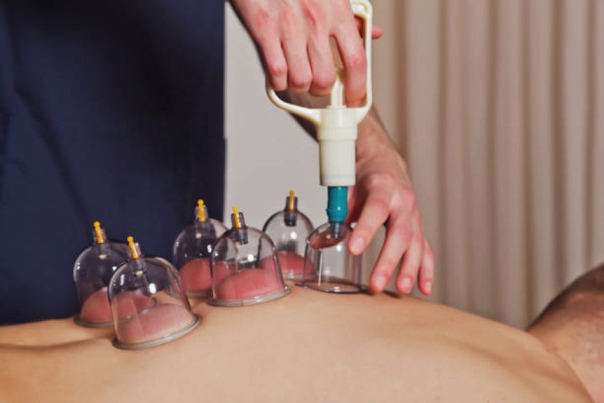 Benefits of Hijama Therapy for Better Health and Wellness