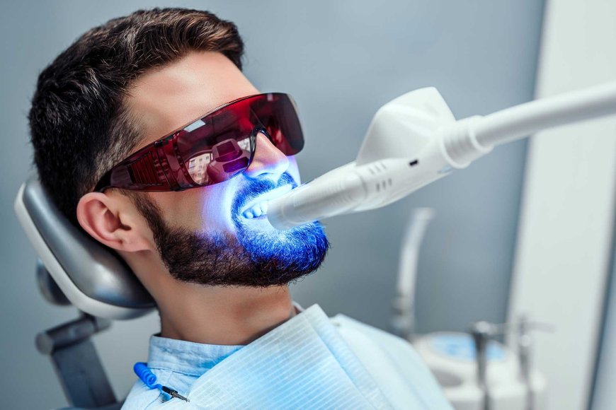 Best Teeth Whitening for Sensitive Teeth – A Complete Patient Guide