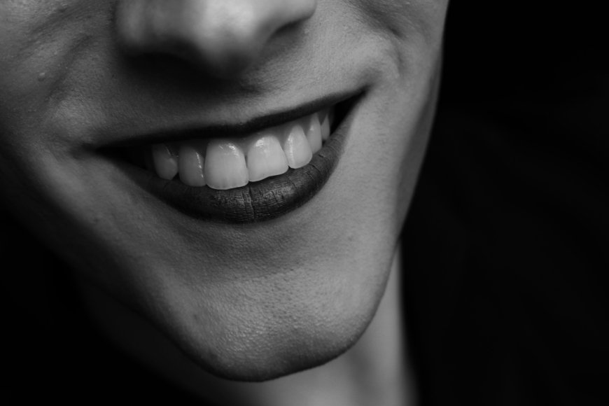 Why Is Turkey Dental Becoming a Preferred Choice for International Patients?