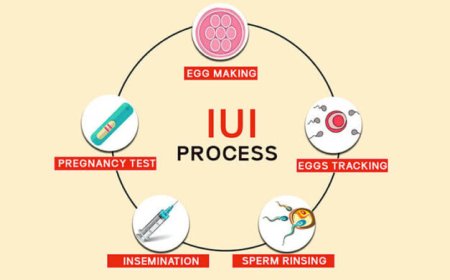IUI Treatment in Delhi - Dr Rhythm Gupta