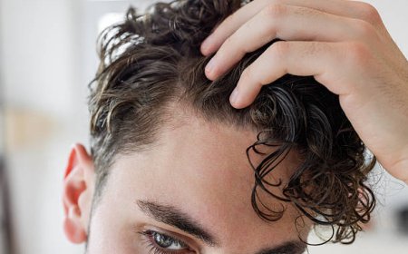 Hair Loss Treatment in Dubai for Stable Hairline Thinning