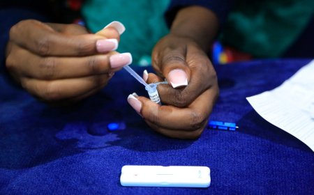 What Happens After a Positive HIV Test?