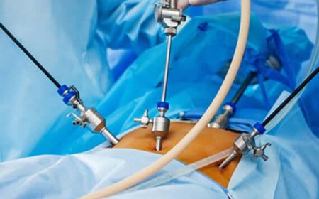 Laparoscopy for Infertility in Delhi - Dr Rhythm Gupta