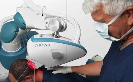 Robotic Hair Transplant in Dubai for Younger Patient Cases