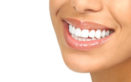 Teeth Whitening in Goregaon: Factors That Can Make Your Smile Look Dull