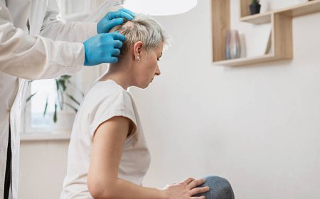 Alopecia Areata Treatment in Dubai for Scalp-Only Patches