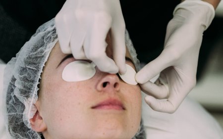 Erbium Peeling vs Other Laser Resurfacing Treatments