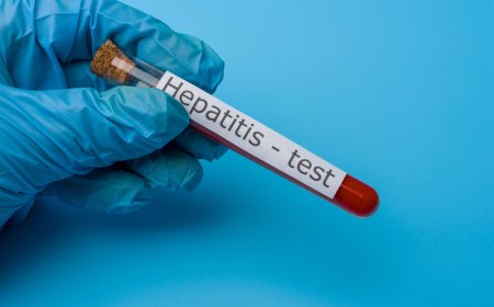 Hepatitis A Test in Dubai: Types and Accuracy