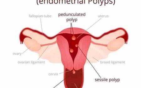 Hysteroscopy Procedure in Delhi - Dr Rhythm Gupta