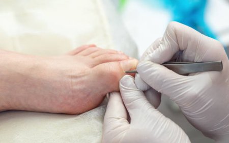When Should You See a Podiatrist for an Ingrown Toenail?