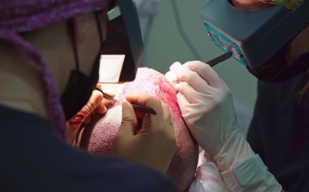 Can FUE Hair Transplant in Dubai Preserve Donor Density During Extraction