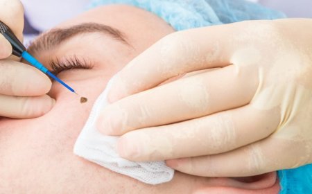 How does a dermatologist examine a mole?