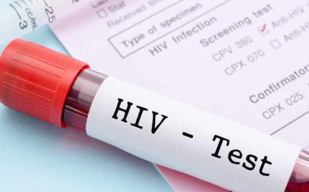 HIV Test in Dubai: Who Should Consider HIV Testing?