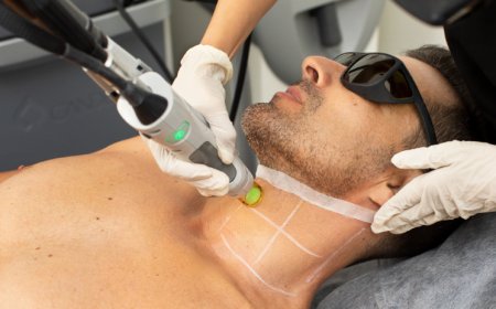 How long does Laser Hair Bleaching Treatment take?