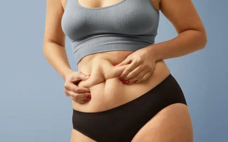 Tummy Tuck Surgery in Delhi - Dr Rajat Gupta