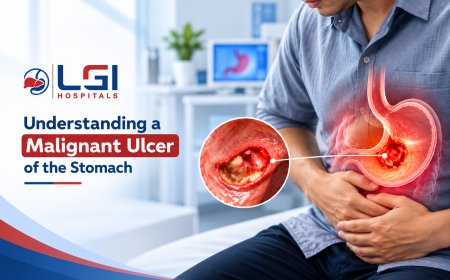 Understanding a Malignant Ulcer of the Stomach: When Acidity Signals Something Serious