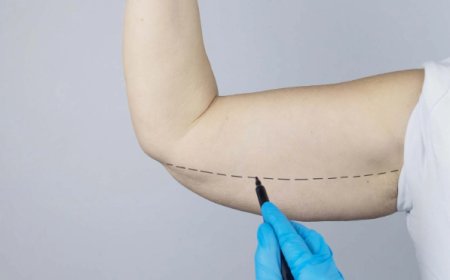 Tips for a Smooth Recovery After Arm Lift Surgery