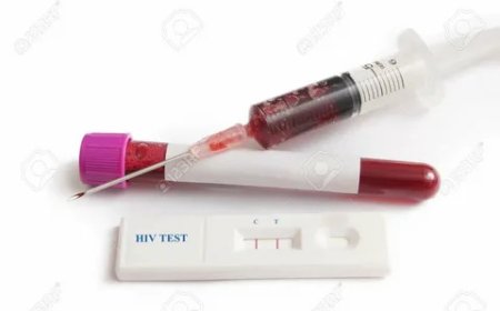 When Should HIV Testing Be Repeated?