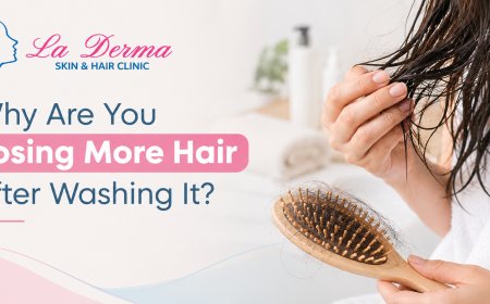 Why Are You Losing More Hair After Washing It?
