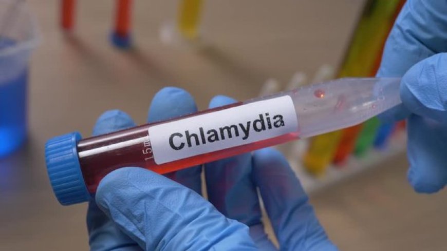 How Accurate Is a Chlamydia Test in Dubai?