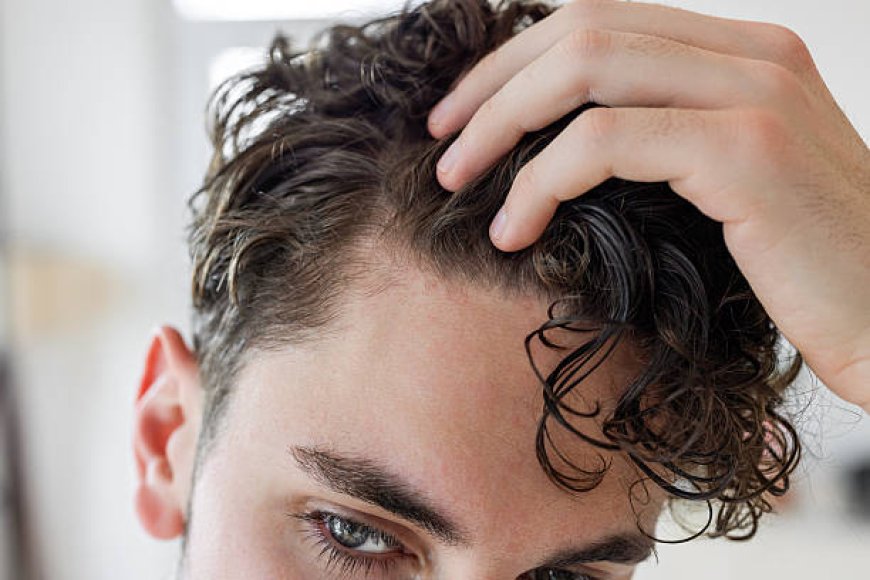 Hair Loss Treatment in Dubai for Stable Hairline Thinning
