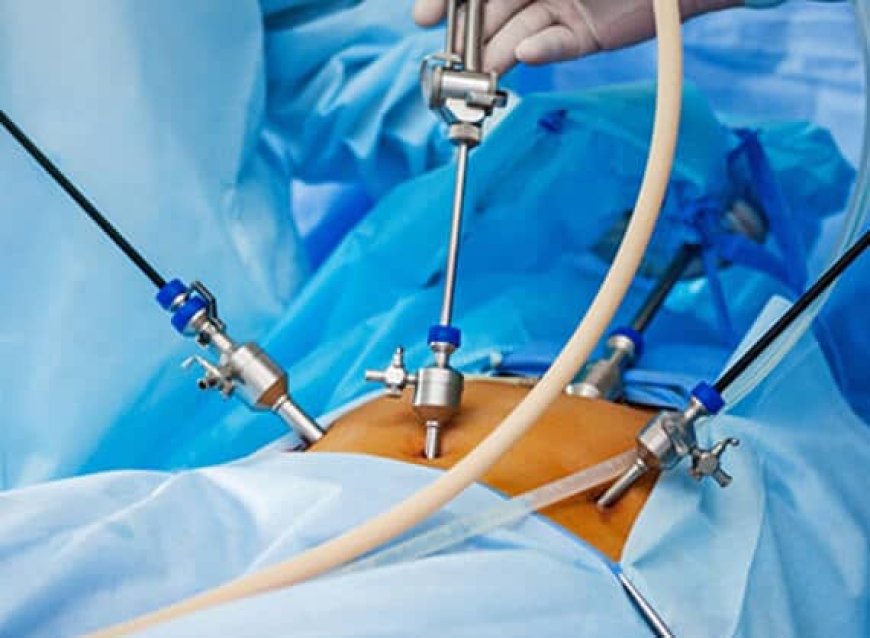 Laparoscopy for Infertility in Delhi - Dr Rhythm Gupta