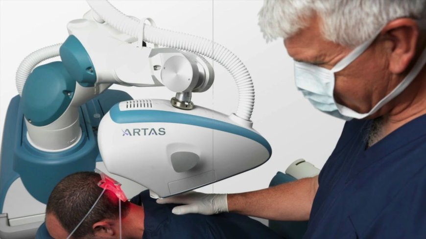 Robotic Hair Transplant in Dubai for Younger Patient Cases