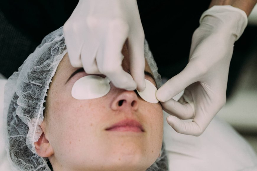 Post-Treatment Care After Erbium Peeling