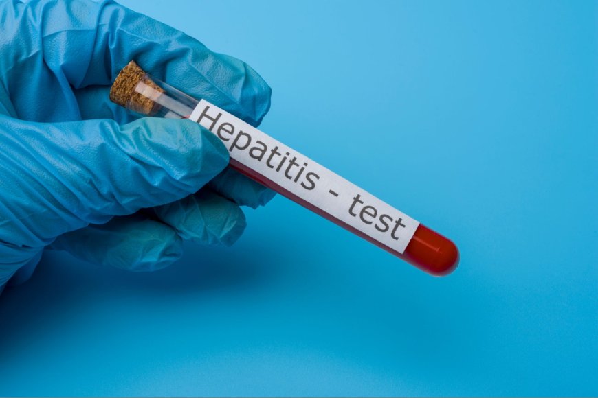 Hepatitis A Test in Dubai: Types and Accuracy