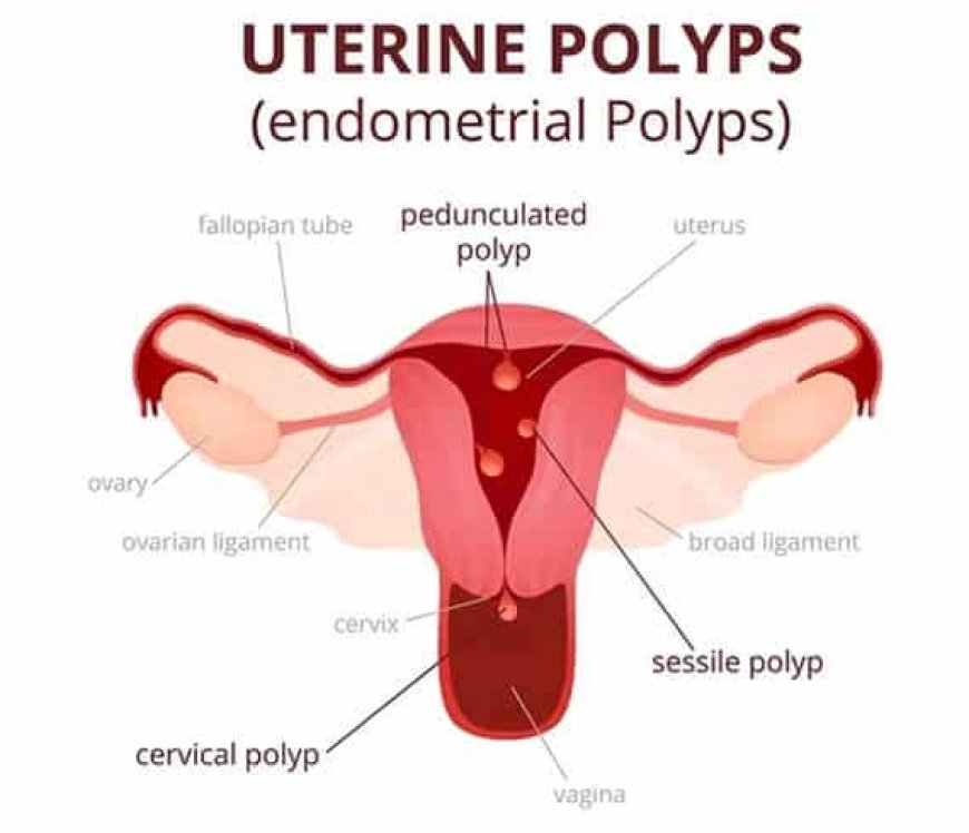Hysteroscopy Procedure in Delhi - Dr Rhythm Gupta