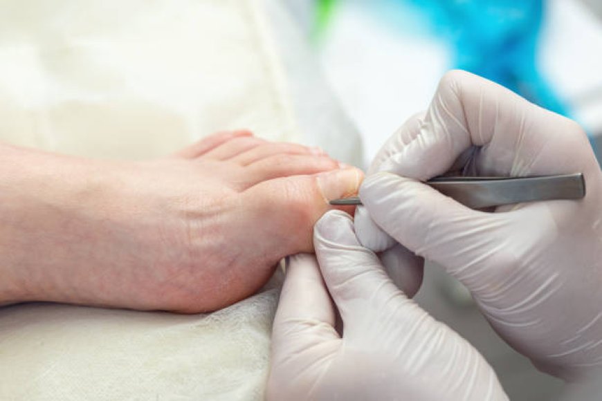 When Should You See a Podiatrist for an Ingrown Toenail?