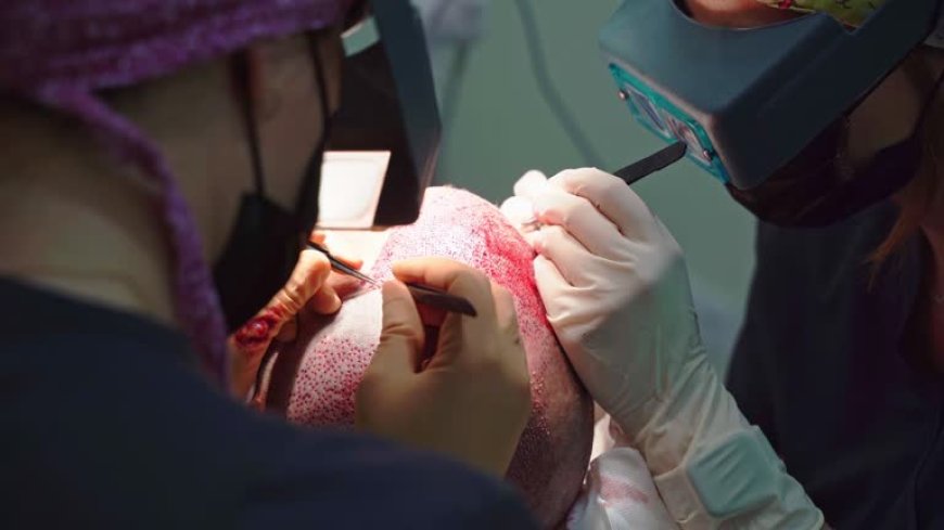 Can FUE Hair Transplant in Dubai Preserve Donor Density During Extraction