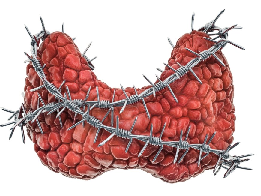 When to Consider Thyroid Goiter Embolization Treatment