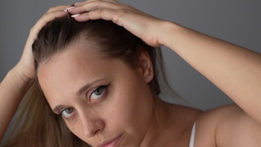Natural Hairline Treatment in Dubai for Widow’s Peak Correction