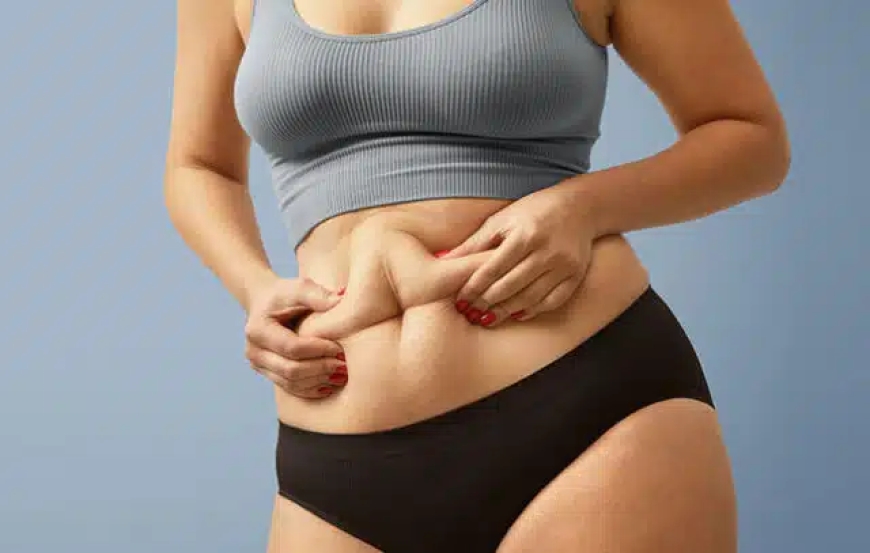 Tummy Tuck Surgery in Delhi - Dr Rajat Gupta