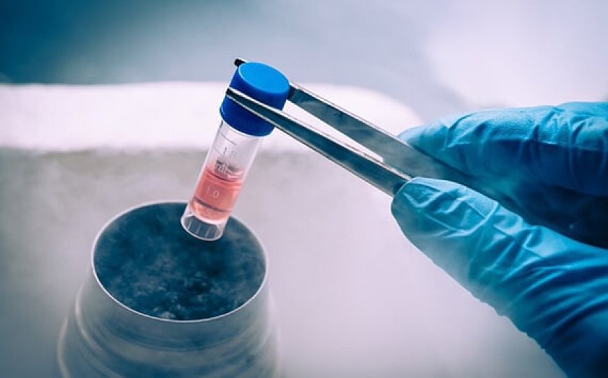 Fertility Preservation in Delhi - Dr Rhythm Gupta